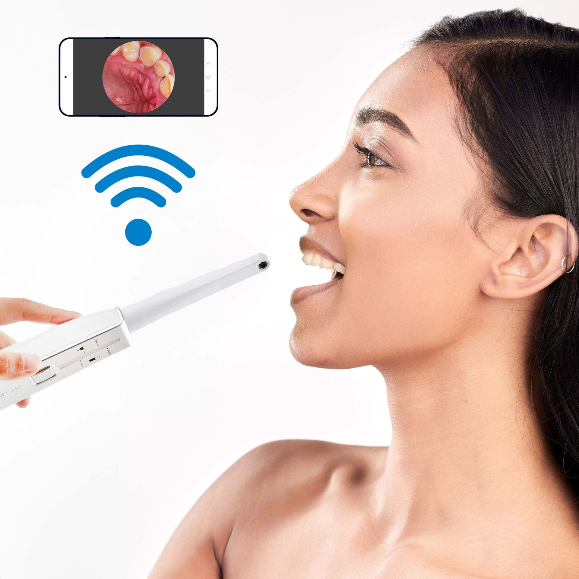 PlatinumCAM Dentalkamera-Aufsatz